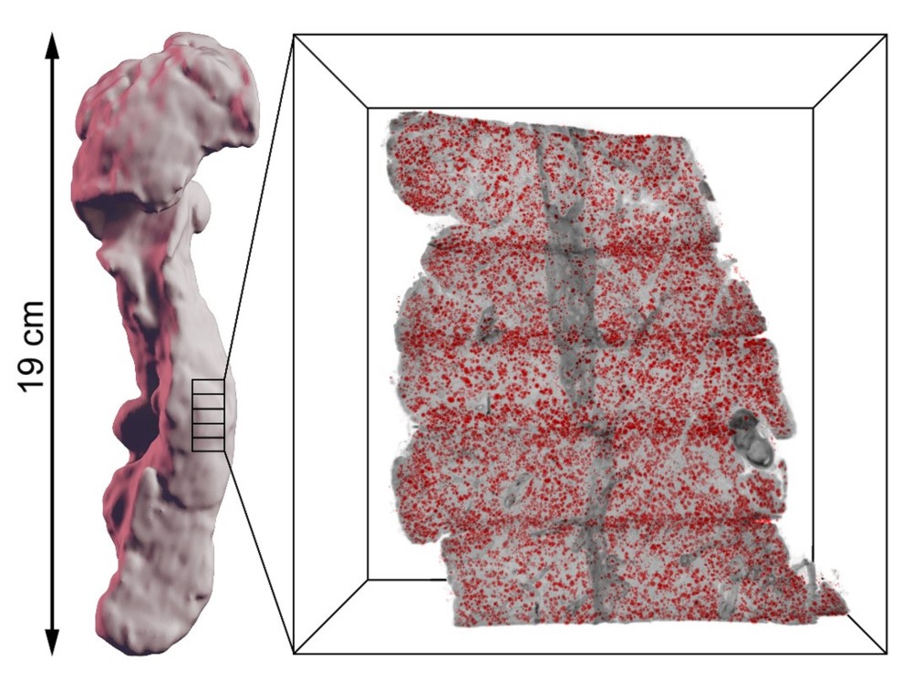 Ny metod möjliggör detaljstudier av mänskliga organ i 3D mynewsdesk.com/se/diabeteswel…
