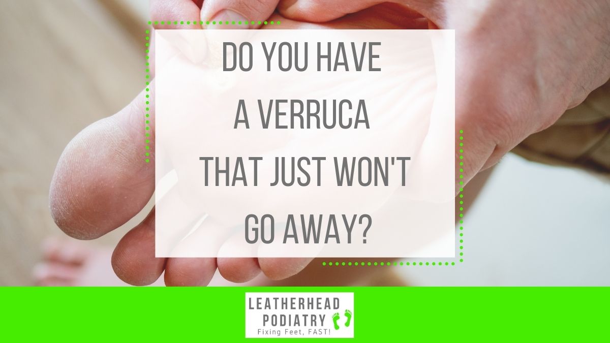 Take a step in the right direction with us here at Leatherhead Podiatry. Call 01372 374125 or visit leatherheadpodiatry.co.uk to discuss your concerns and book an appointment.

#LeatherheadPodiatry #FixingFeetFast #PodsFixFeet #PodiatryClinic #Leatherhead #Surrey