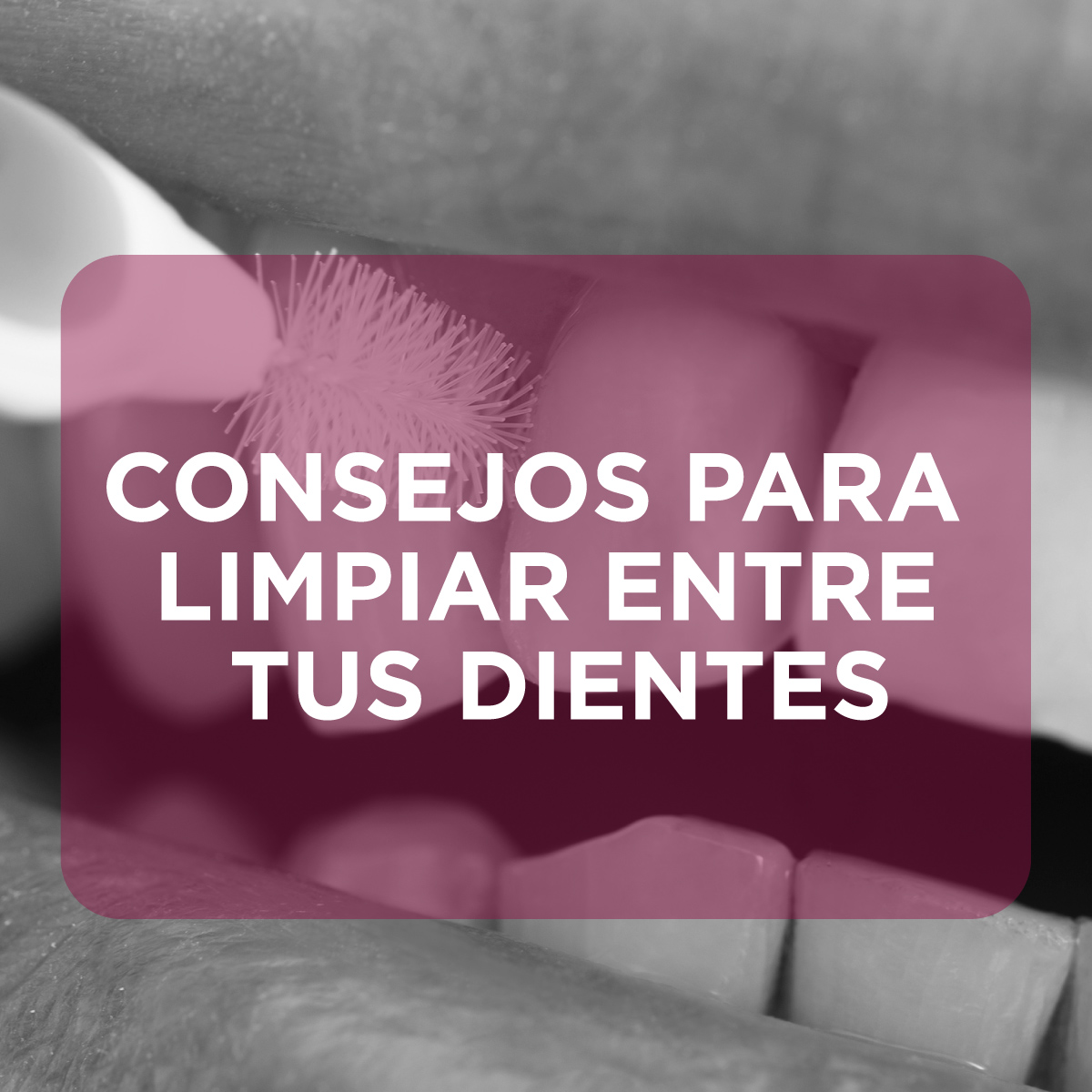 InsDental's tweet photo. ¡Limpiar entre tus dientes es sumamente importante!
Los residuos acumulados en los recovecos contribuyen a la formación de placa.
Además, evitaremos caries y mancha y la aparición de sarro.
¡No olvides limpiar entre tus dientes después del cepillado!
👉https://t.co/uBvEobVkBt https://t.co/5ESMwWwywK