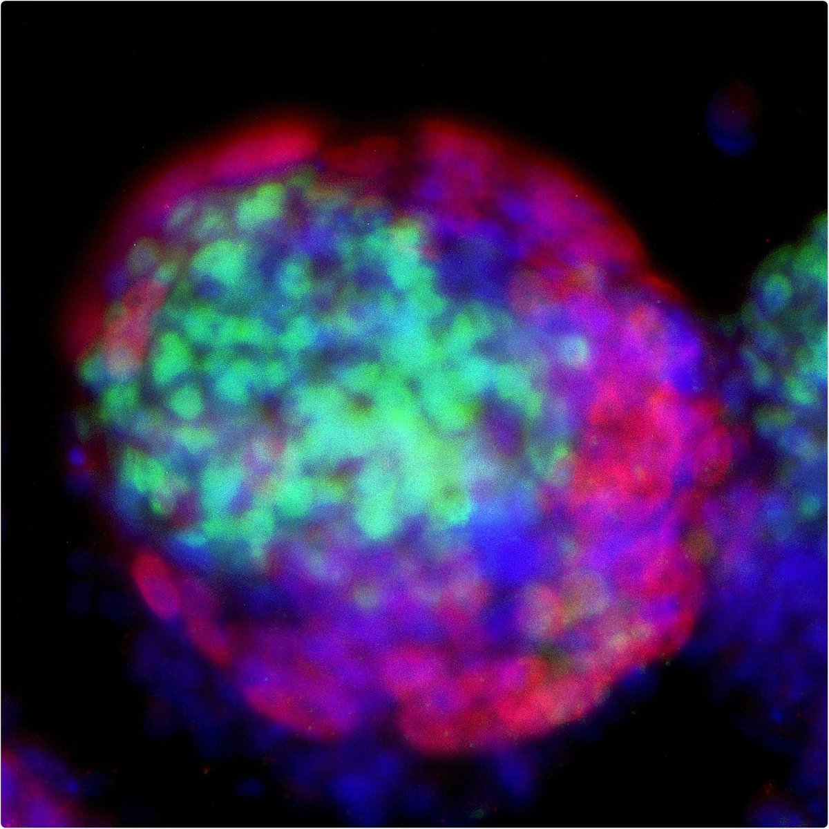 Journal of Fertilization: In Vitro - IVF-Worldwide tweet media