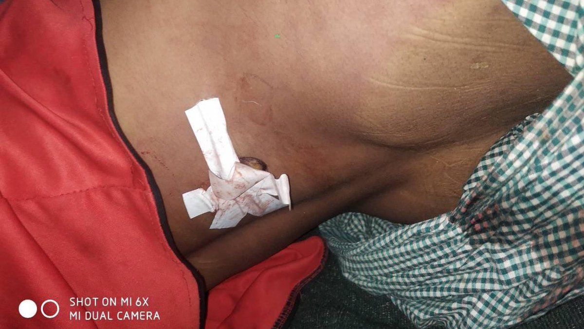 shafiur's tweet photo. Patheingyi Township

MOCKING DEATH CERTIFICATE ISSUED BY SAC ADMIN

17yr boy shot dead on 12 Sept. circa 10pm when passing in front of SAC camp. Another injured. Family received death certificate, given by Ohn Chaw administrator. Cause was “Alcoholism.” #WhatsHappeninglnMyanmar https://t.co/SQqxr1UEc9