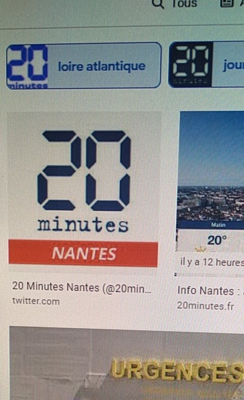 LOuiedeLouis's tweet photo. Interview demain par une journaliste de #20minutes @20minutesnantes #Nantes pour faire connaître la #microtie #atresie #aplasie,
et notre parcours avec Louis et l'asso @LOuiedeLouis.
#presse https://t.co/U2Ul81tuLe