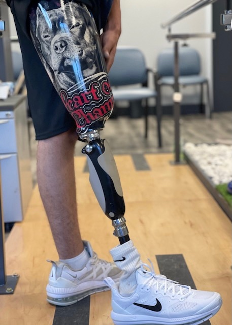 Limbionics's tweet photo. Looking sharp! New leg in Raleigh with an awesome design on the socket and great alignment.  Another happy walker!          

#prosthetic #prosthetics #amputee #amplife #limbionics #rdu #raleigh #newbern #goldsboro #durham #henderson #walk https://t.co/pNcQejAVHA