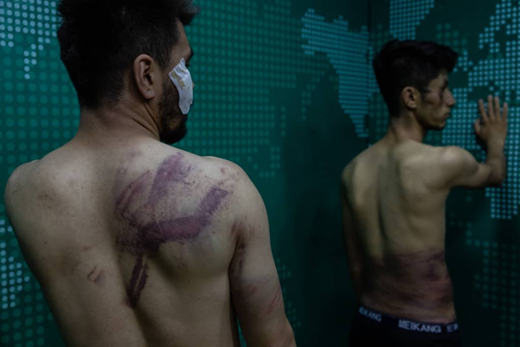 #13sep | 🇦🇫 Se dieron a conocer relatos estremecedores sobre la detención y la brutal agresión de los talibanes a los periodistas que cubrían en apoyo a los derechos de las mujeres, la cual tuvo lugar el miércoles.