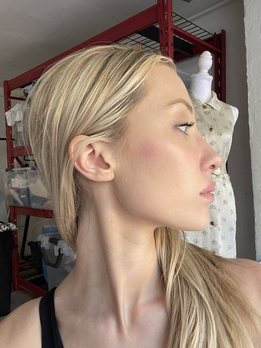 A skeeter bit me https://t.co/6SrKQxETo5