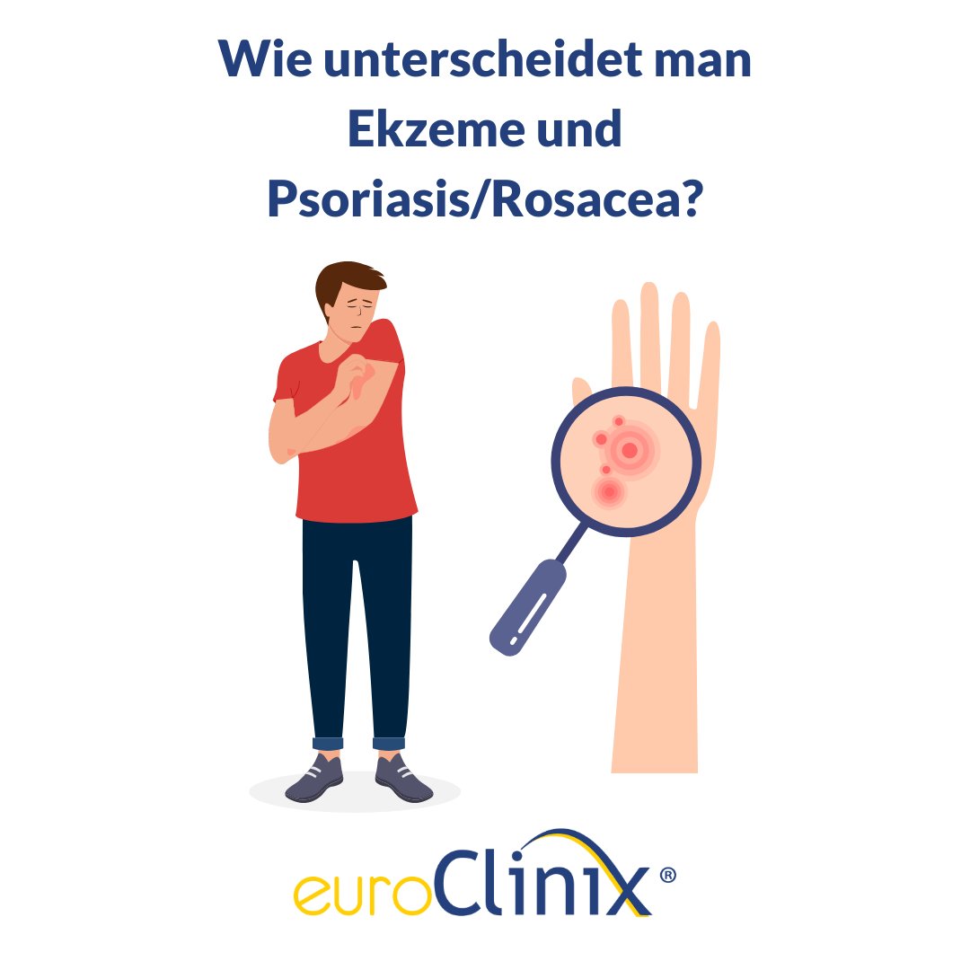 Ekzeme und Psoriasis/Rosacea: 

Juckende und rote Haut kann ein frustrierendes Problem sein und Ihr allgemeines Wohlbefinden beeinträchtigen.

#hautpflege #hautpflegetipps #unreinehaut #pickel
#ganzheitlichehautpflege #aknebehandlung #neurodermitis #sensiblehaut #empfindlichehaut