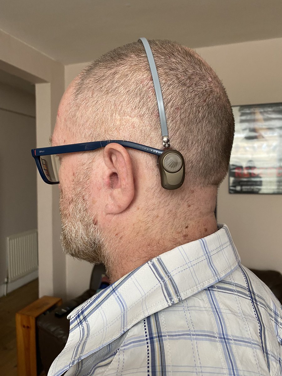 marklaverick's tweet photo. So this is what I’m trialling the next few weeks on my profoundly deaf left side. Depending on how I get on with this I actually have three or four options open to me. Looking into either a #BAHA or #BoneBridge implant. https://t.co/Bgqpt33Rxd