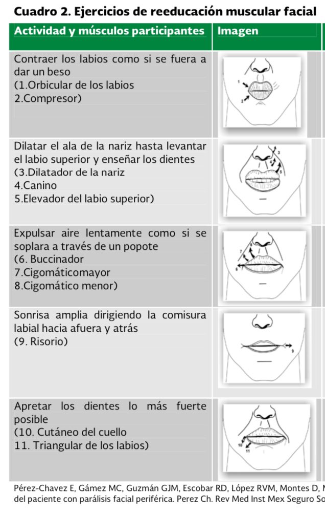 Parálisis Facial Gpc Ejercicios – FYNSR