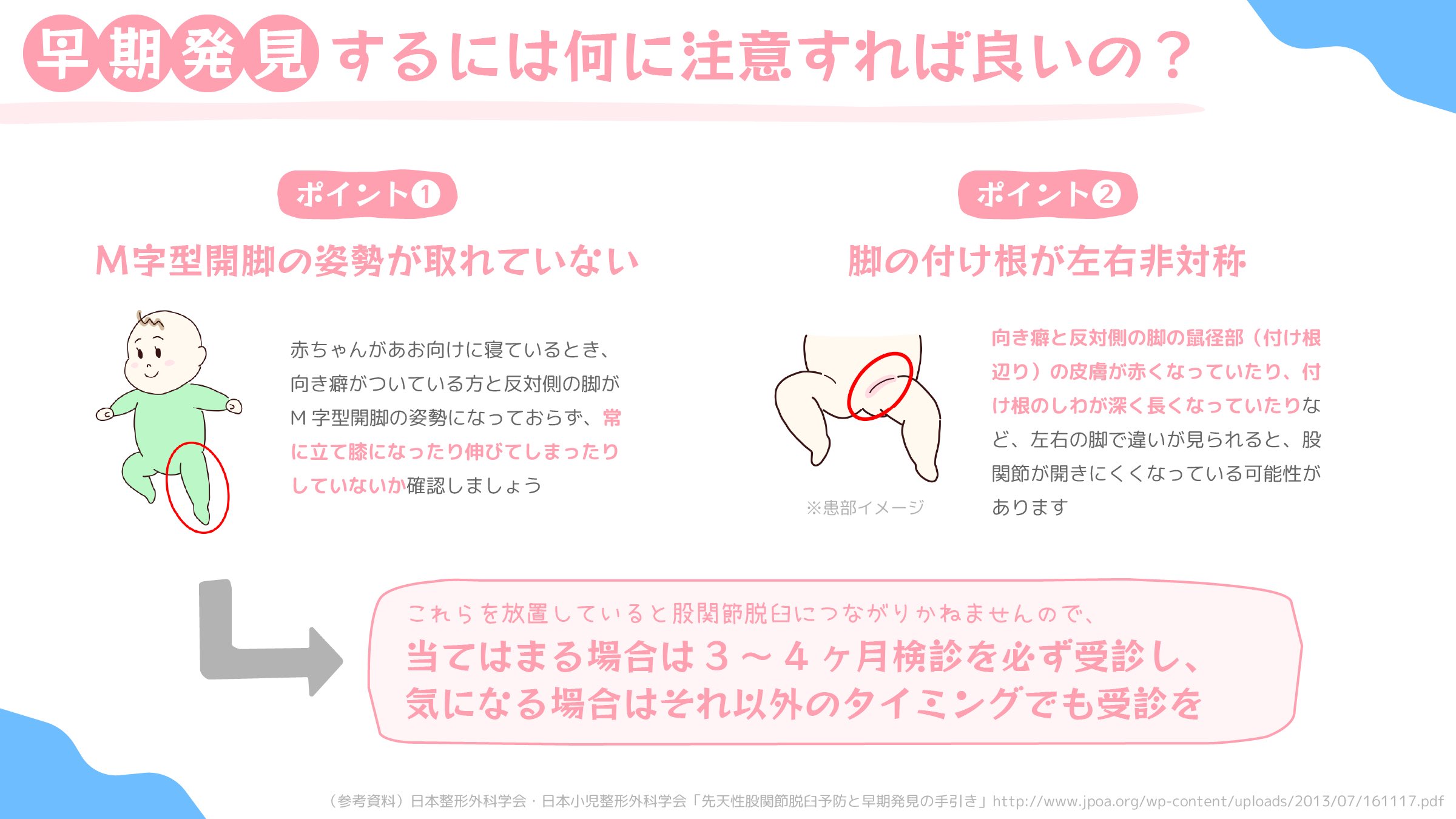 赤ちゃんが先天性股関節脱臼にならないために 小児科オンラインジャーナル