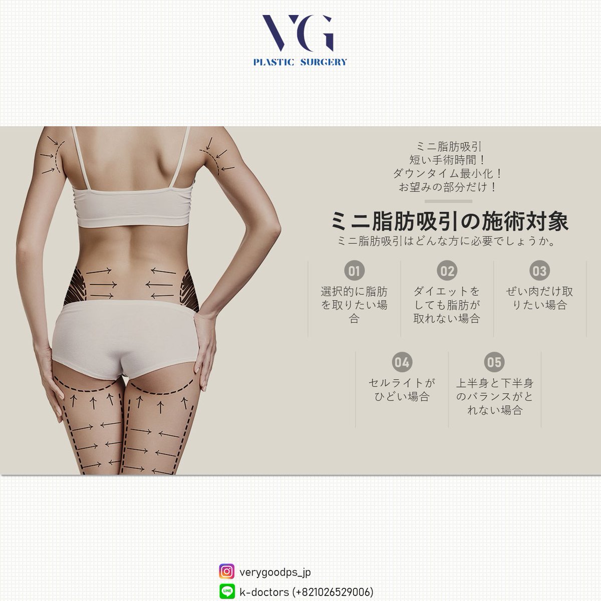 verygoodps_jp's tweet photo. 隠れていた私の美しいライン、
ベリーグッド整形外科で完成してみましょう！
#脂肪吸引 #ボディライン #二重顎 #顎ライン #ヒップライン #ダイエット https://t.co/1py5I6WVHL
