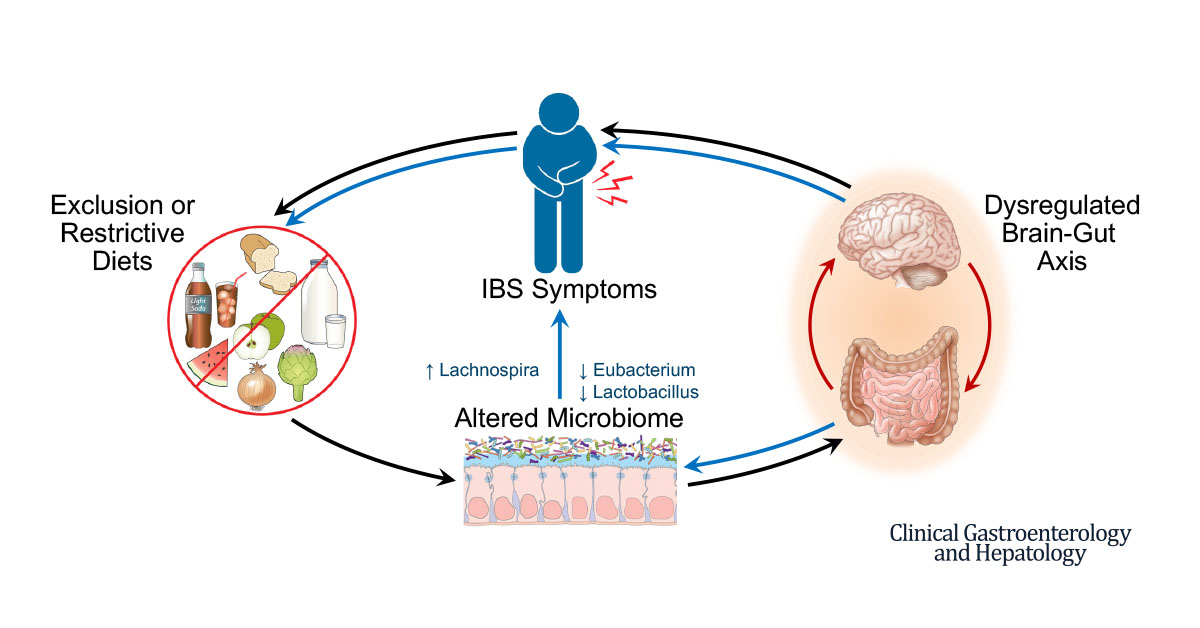 Lin Chang (@linchangmd) on Twitter photo 🎧 <a href="/Gastro_Network/">Gastroenterology Learning Network</a> podcast 👇on our study on restrictive diets & #microbiome in #IBS in <a href="/AGA_CGH/">CGH</a>
➡️ IBS pts w/worse sxs more likely to eat restrictive diets & this is assoc w/changes in microbiome
👏 Great work A Lenhart <a href="/SwapnaJoshi_PhD/">Swapna Mahurkar-Joshi, PhD</a> <a href="/TienDongMD/">Tien Dong MD, PhD</a> 👉 bit.ly/399upFW 🎧 <a href="/Gastro_Network/">Gastroenterology Learning Network</a> podcast 👇on our study on restrictive diets & #microbiome in #IBS in <a href="/AGA_CGH/">CGH</a>
➡️ IBS pts w/worse sxs more likely to eat restrictive diets & this is assoc w/changes in microbiome
👏 Great work A Lenhart <a href="/SwapnaJoshi_PhD/">Swapna Mahurkar-Joshi, PhD</a> <a href="/TienDongMD/">Tien Dong MD, PhD</a> 👉 bit.ly/399upFW
