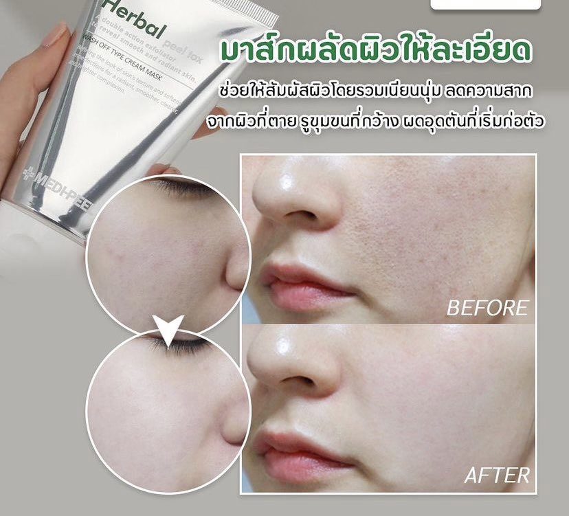 PPPYKS's tweet photo. ส่งต่อ Herbal peel tox ของMedipeel มาส์กเคลียร์ผิวสาก ผลัดเซลผิวที่ตายแล้วอย่างอ่อนโอน ผิวดูกระจ่างใสขึ้นทันทีหลังมาส์กค่ะ ปริมาณ50% 190฿พร้อมโอนส่งฟรี ใครสนใจdm มาได้เลยนะคะ #ส่งต่อ #ส่งต่อสกินแคร์ #ส่งต่อคสอ #ส่งต่อคสอมือสอง #ส่งต่อเครื่องสําอาง https://t.co/GFhuIEyXq8