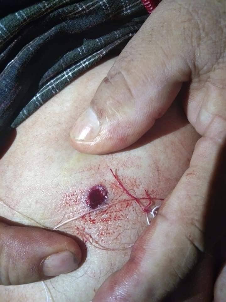 NoraLoNL's tweet photo. During 3-hours shootouts in Karenni’s Loikaw Tsp last night, Junta Terrorists fired indiscriminate rounds &amp; heavy artillery at random, wounding a man &amp; damaging several houses with shells and ammos.  #WhatsHappeningInMyanmar  #Sep14Coup https://t.co/YXXZ1qhJzT