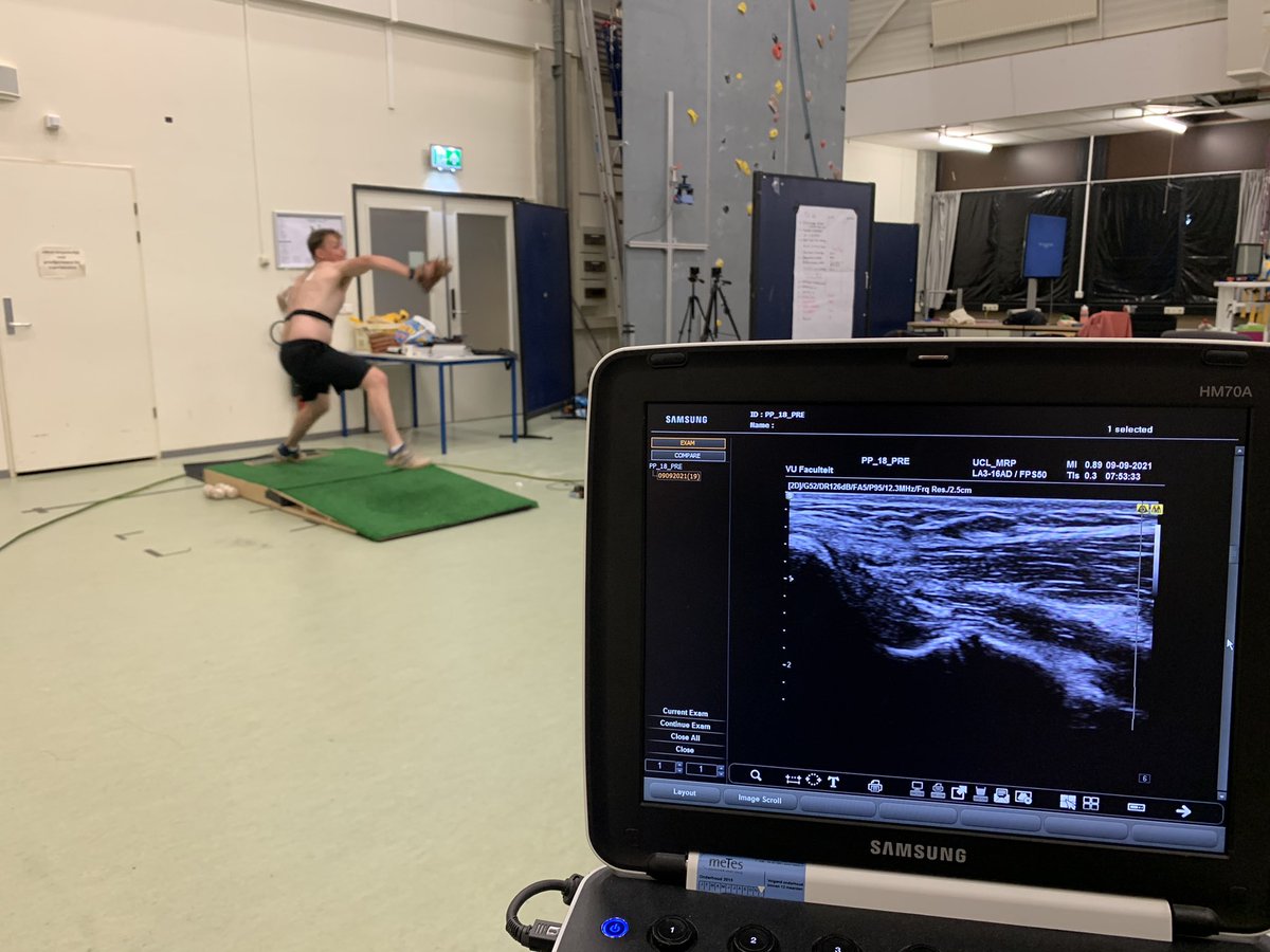 Bart van Trigt (@bartvantrigt) on Twitter photo Preventing baseball pitchers from elbow injuries, we investigate the elbow characteristics in baseball ⚾️ pitchers <a href="/HonkbalSoftbal/">HonkbalSoftbalNL</a> <a href="/honkbalopzolder/">Honkbal Op Zolder</a> <a href="/tudelft3mE/">TU Delft | ME (Inactive. Please follow @tudelftme)</a> #baseball <a href="/antoniusleenen/">Ton Leenen</a> Preventing baseball pitchers from elbow injuries, we investigate the elbow characteristics in baseball ⚾️ pitchers <a href="/HonkbalSoftbal/">HonkbalSoftbalNL</a> <a href="/honkbalopzolder/">Honkbal Op Zolder</a> <a href="/tudelft3mE/">TU Delft | ME (Inactive. Please follow @tudelftme)</a> #baseball <a href="/antoniusleenen/">Ton Leenen</a>
