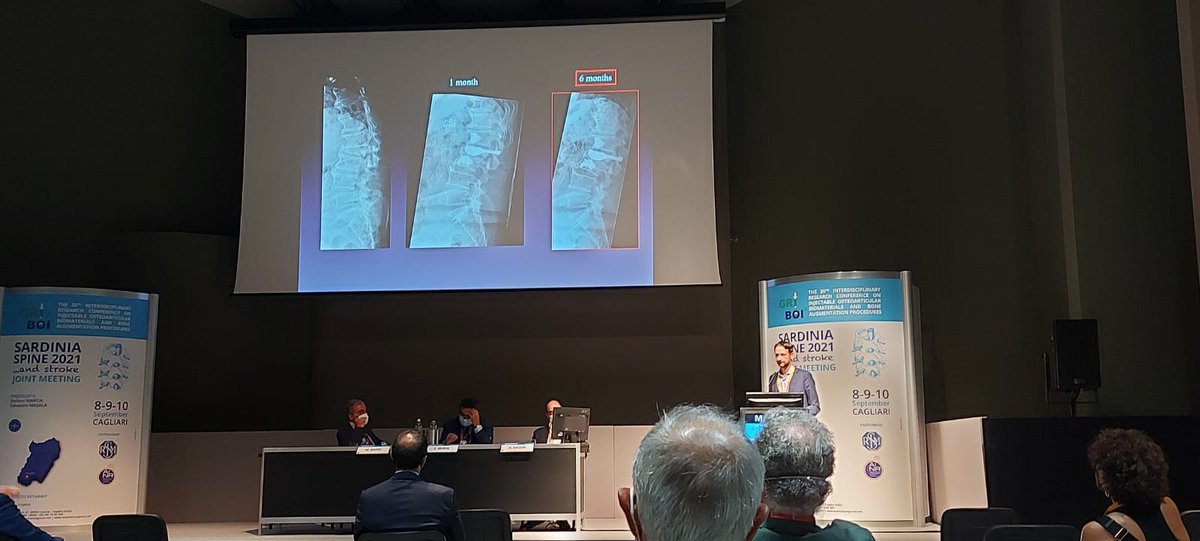 Rossi1Andrea's tweet photo. @Marco_Pileggi #interventional #neuroradioligist, del #neurocentro #EOC #Lugano interviene su:
“Screw-assisted internal fixation of severe benign an malignant vertebral fractures”
scuola del Prof #Cianfoni Primario #neuroradiologia https://t.co/nm6dc9Gctd