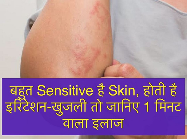 NariKesari's tweet image. गर्मी या बरसात में दाद-खाज , खुजली की समस्या आम देखने को मिलती है, जिसे डॉक्टरी भाषा में एक्जिमा रोग भी कहते है।

#Skinproblem #Summerproblem #Infections #Redskin #SkinAllergies #SensitiveSkin #Health

nari.punjabkesari.in/nari/news/home…