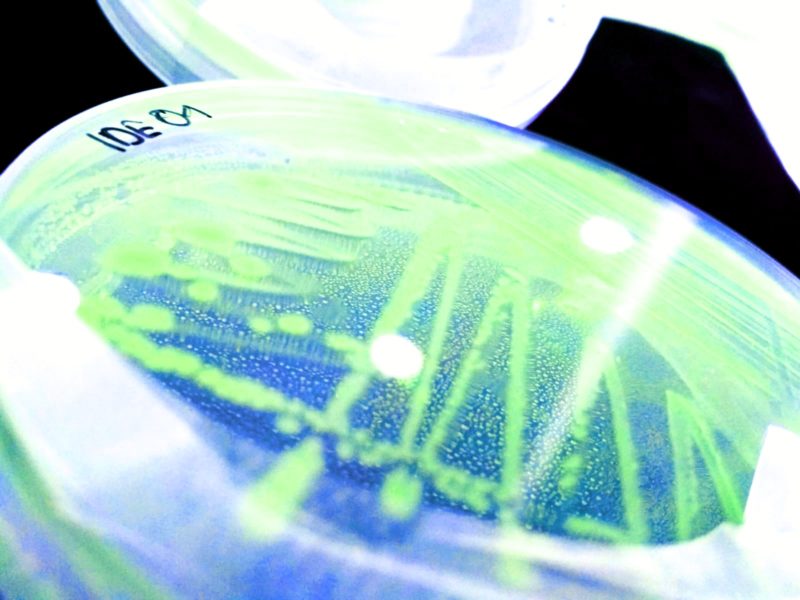 ideagro's tweet photo. 👨🏼‍🔬 🦠 En #IDEAGRO disponemos de un #laboratotio totalmente equipado para la realización de análisis físico-químicos, #microbiológicos y de #calidad.

➡️ https://t.co/XKQs5NVtPV

#somosIDEAGRO / #IDEAGROinnova https://t.co/XHohHVqvoR
