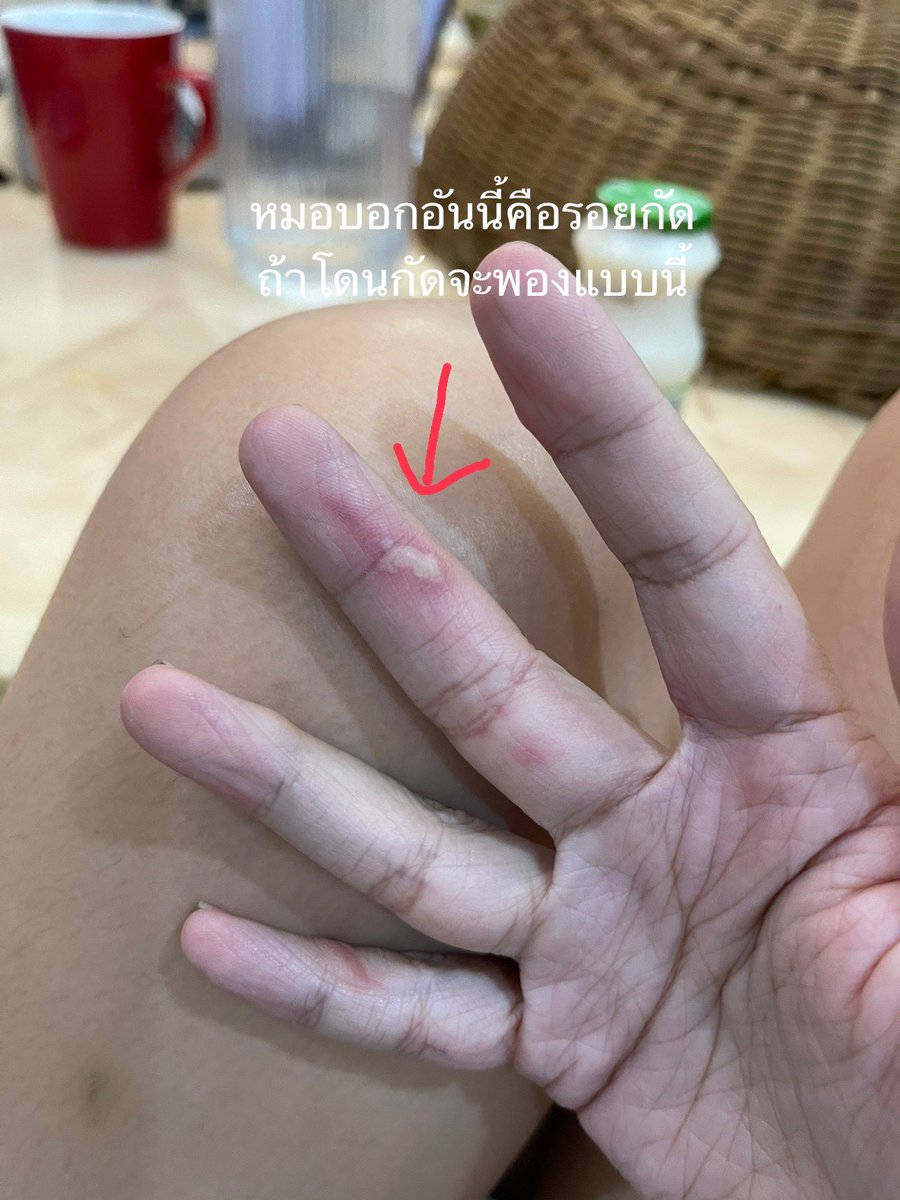 ลูกแก้วและหมาของเขา tweet media