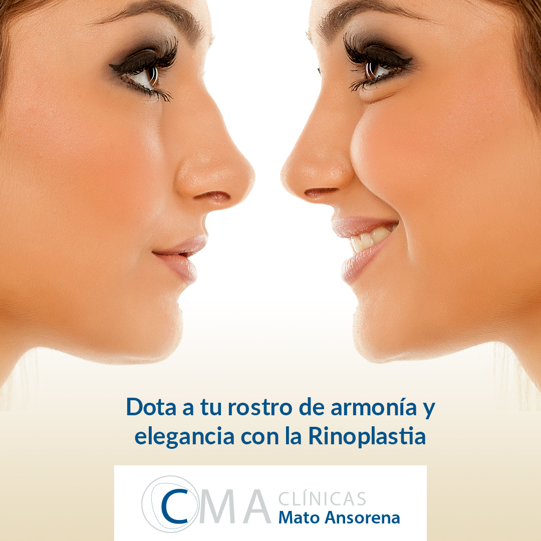 mato_ansorena's tweet photo. Una de las operaciones estéticas más demandadas por mujeres y hombres de todo el mundo es la rinoplastia
Es importante elegir un buen equipo en el que confiar
El Dr Mato A.Tiene más de 30 años realizando rinoplastias con resultados excelentes
 Madrid 915626505 
Sevilla 955223633 https://t.co/JziJgA3QNq