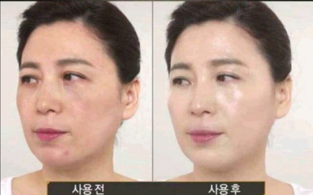 MakeupSogood's tweet photo. #ทาฝ้าตัวดังของเกาหลี
สูตรปรับปรุงใหม่ล่าสุด
280 บาท ส่งฟรี

 DONGSUNG Rannce Max Prestige Whitening Cream 20g
ครีมฝ้าอันดับ 1 ของผู้หญิงเกาหลี 
#DONGSUNGRannce #ครีมทาฝ้าเกาหลี #สกินแคร์เกาหลี  #dongsung​ #ฝ้า #DONGSUNGCream #DongsunGMAX
#DONGSUNGRannceMaxPrestigeWhiteningCream https://t.co/lTOwzpAgY8