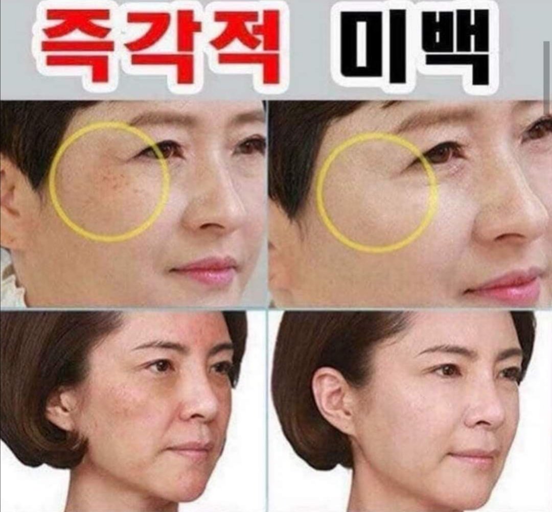 MakeupSogood's tweet photo. #ทาฝ้าตัวดังของเกาหลี
สูตรปรับปรุงใหม่ล่าสุด
280 บาท ส่งฟรี

 DONGSUNG Rannce Max Prestige Whitening Cream 20g
ครีมฝ้าอันดับ 1 ของผู้หญิงเกาหลี 
#DONGSUNGRannce #ครีมทาฝ้าเกาหลี #สกินแคร์เกาหลี  #dongsung​ #ฝ้า #DONGSUNGCream #DongsunGMAX
#DONGSUNGRannceMaxPrestigeWhiteningCream https://t.co/lTOwzpAgY8