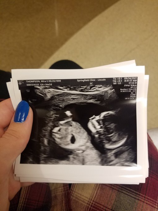 it's a boy!!💙👶🤰🍼 https://t.co/Srtp8ItQHv