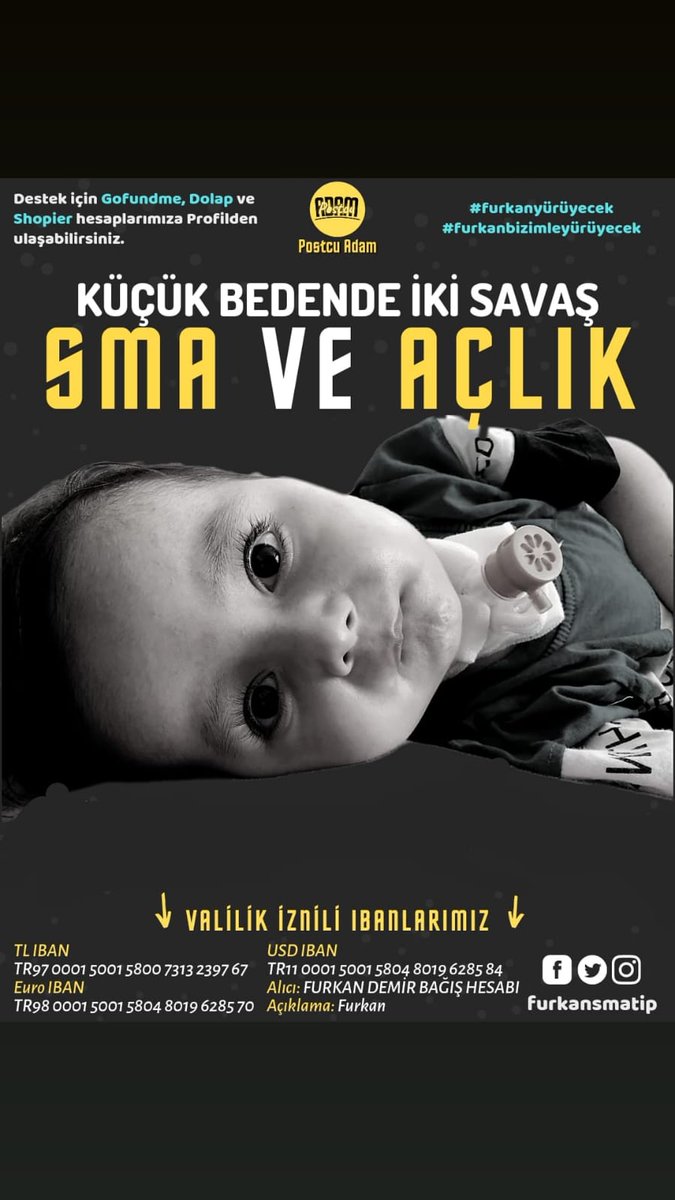 furkansmatip's tweet photo. Biz "Furkan 3 kilo daha alırsa tedavi olamaz" diyorduk. Malesef Furkan 1 kilo almış😔 Artık sona doğru yaklaşıyoruz. Artık vaktimiz çok daha az. Furkan'ı ölüme terk etmeyin ne olur! Kampanyamıza destek olun. Furkan'ı anlatarak sesimizi duyurun🙏

TV 8 Acun #AppleEvent #BarışArduç https://t.co/VJMD3dmLDp