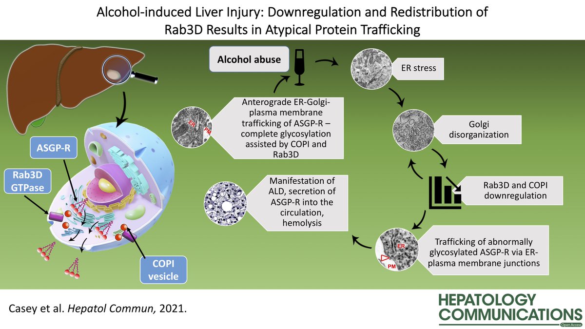 Hepatology Communications (@hepcommjournal) on Twitter photo Alcohol-Induced Liver Injury: Down-regulation and Redistribution of Rab3D Results in Atypical Protein Trafficking
aasldpubs.onlinelibrary.wiley.com/doi/10.1002/he…
#alcoholliverdisease #livertwitter #VisualAbstract #openaccess <a href="/armpetr/">Armen Petrosyan</a> Alcohol-Induced Liver Injury: Down-regulation and Redistribution of Rab3D Results in Atypical Protein Trafficking
aasldpubs.onlinelibrary.wiley.com/doi/10.1002/he…
#alcoholliverdisease #livertwitter #VisualAbstract #openaccess <a href="/armpetr/">Armen Petrosyan</a>