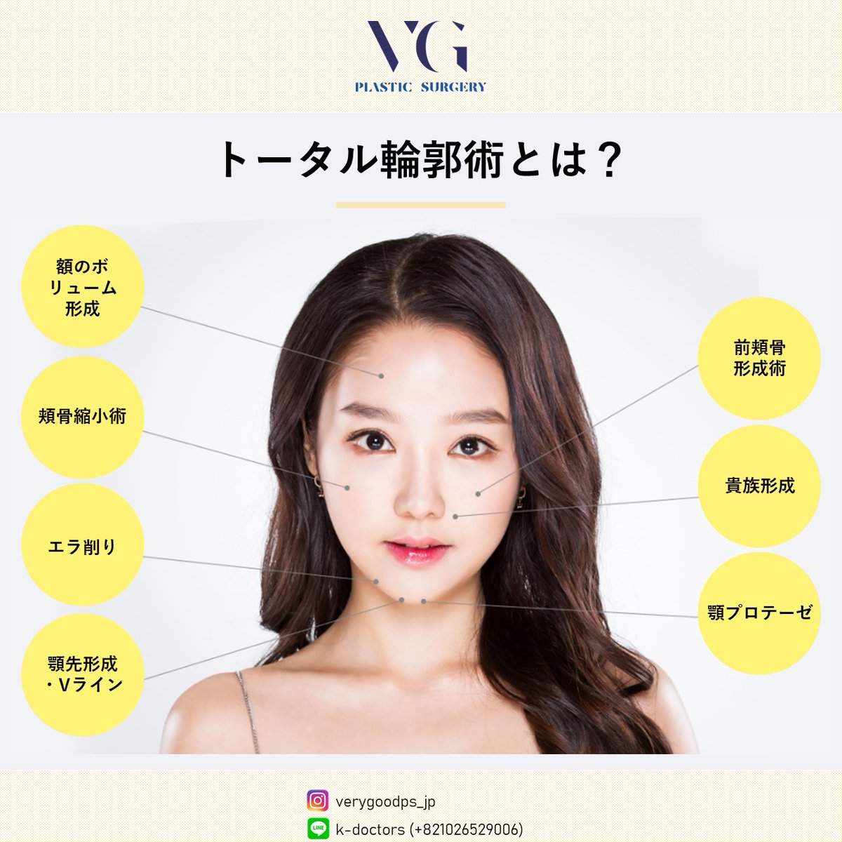 verygoodps_jp's tweet photo. 自分に似合う顔ラインのために、必要な手術方法を複合的に選択し、立体感のあるフェイスラインにお作りします。
#輪郭 #エラ削り #頬骨縮小 #骨切り #顎先 #小顎 https://t.co/5yLTocDbkn
