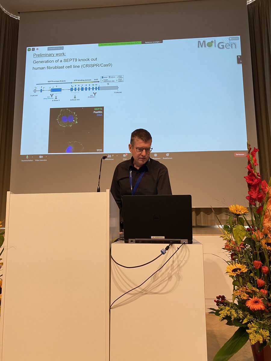 Septin2021's tweet photo. Thomas Gronemeyer presents his new work on SEPT9 interacting molecules in cell migration. #EMBOSeptin2021 https://t.co/WTtc5F6ZJy