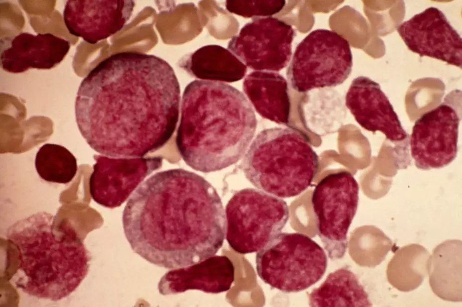 RestingUser2's tweet photo. #Headline New findings show that common pesticides at home could increase a child's risk of getting #Leukaemia by up to 47% @Lotusfm #sabcnews https://t.co/h6uxWXIqfF