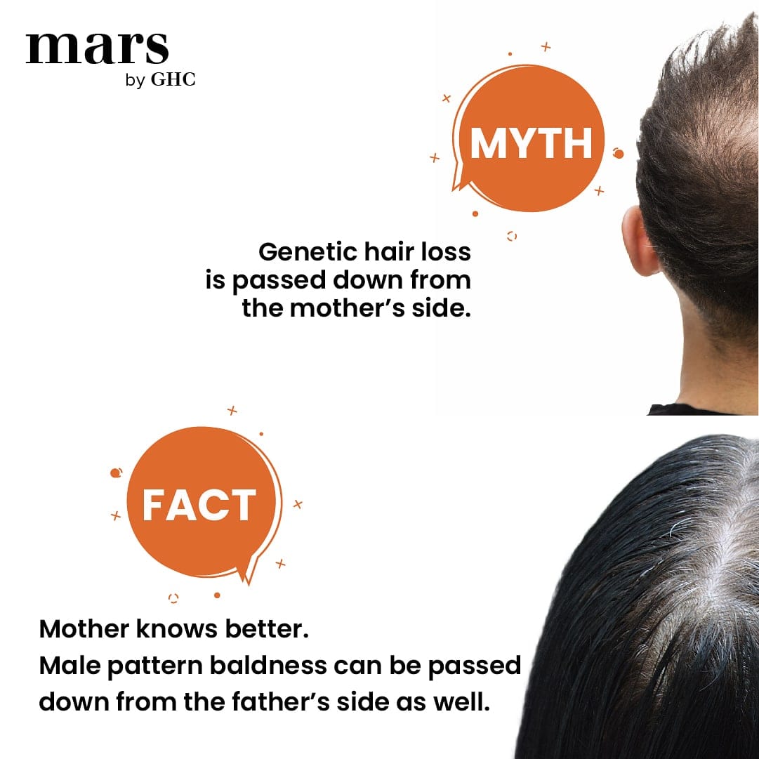SMP INK on Twitter Hair loss affects many Americansone in five Americans  experiences some form of hair loss The most common type of hair loss is  known as male or female pattern