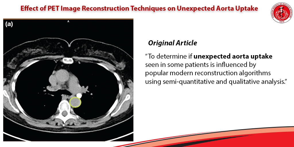 MIRTOfficial's tweet photo. Effect of PET Image Reconstruction Techniques on Unexpected Aorta Uptake
#Positronemissiontomography #computedtomography #aorta #bloodpool #quantitative
▪️https://t.co/jMqJ2CALyc https://t.co/tFidn3qBdi