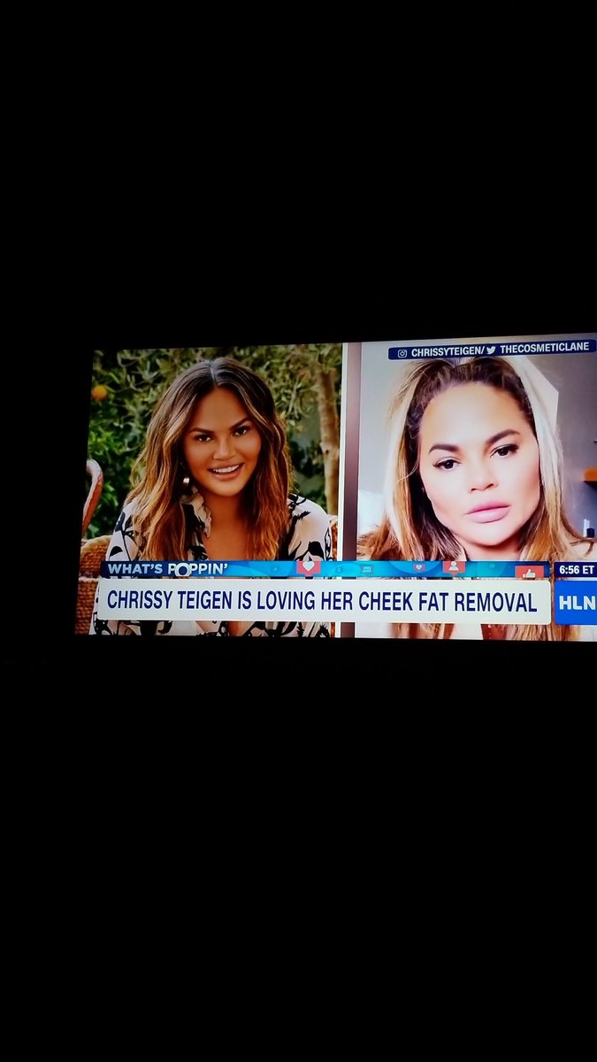 wboaz's tweet photo. @chrissyteigen left looks much better https://t.co/PxRfHrjQfC