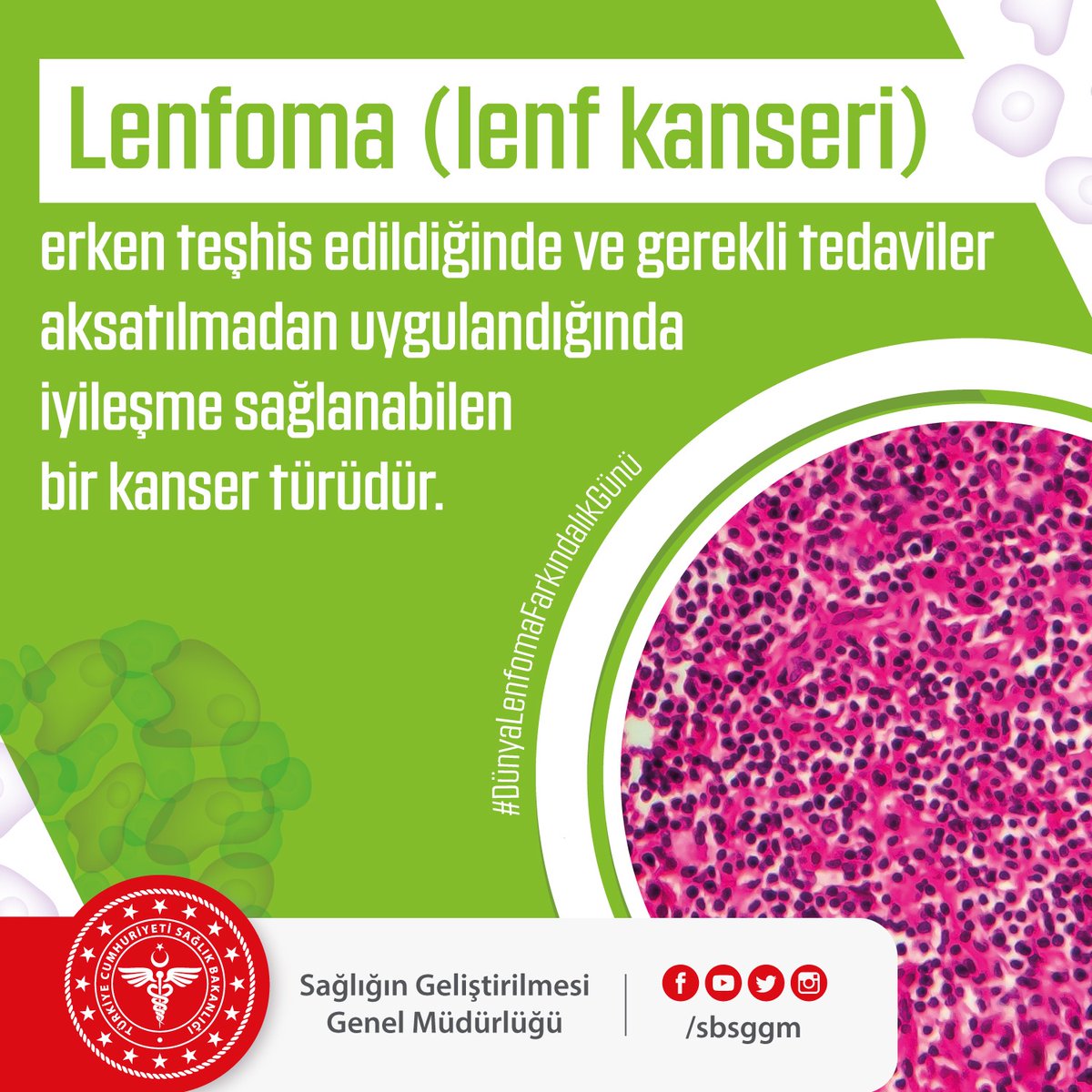sbsggm's tweet photo. Lenfoma (lenf kanseri) erken teşhis edildiğinde ve gerekli tedaviler aksatılmadan uygulandığında iyileşme sağlanabilen bir kanser türüdür. #DünyaLenfomaFarkındalıkGünü https://t.co/WrQUXSlYA1