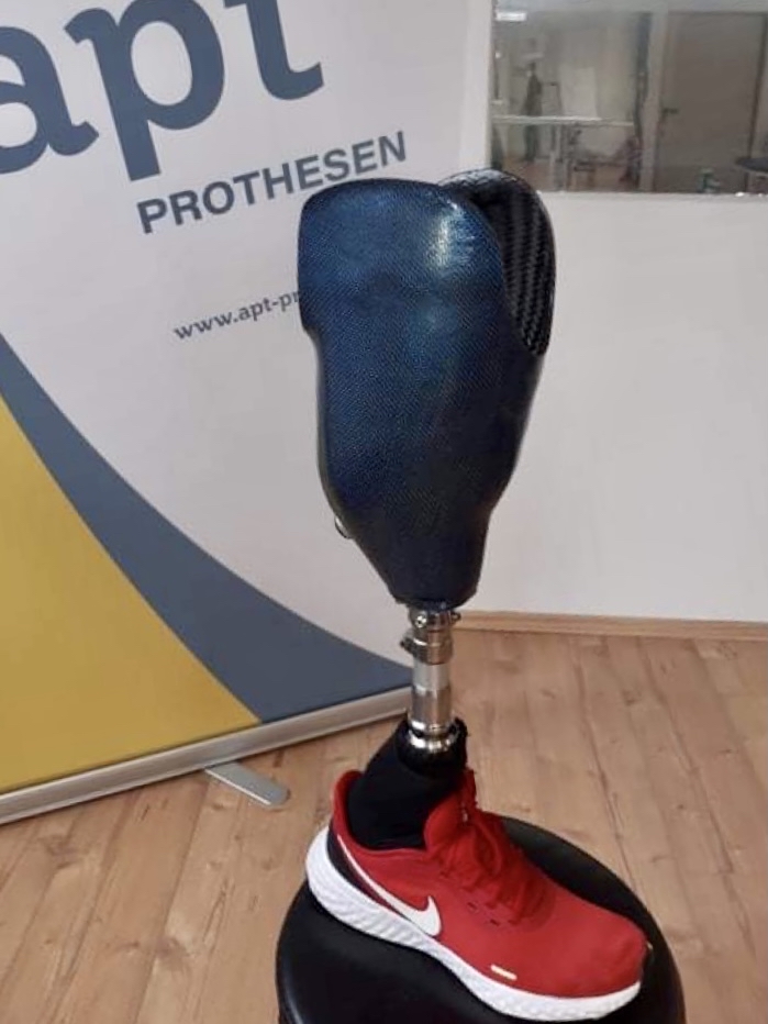 AProthesen's tweet photo. Nach einigen gesundheitlichen Rückschlägen kann Dennis nun endlich mit seiner Prothese durch die Gegend laufen. Viel Freude mit dem Gerät! 🦿
#aperfectteam

#prothese #beinprothese #colourful #blue #aptprothese #orthopädietechnik #ostwestfalen #badlippspringe #paderborn #bionic https://t.co/Pm0BLC5k6u