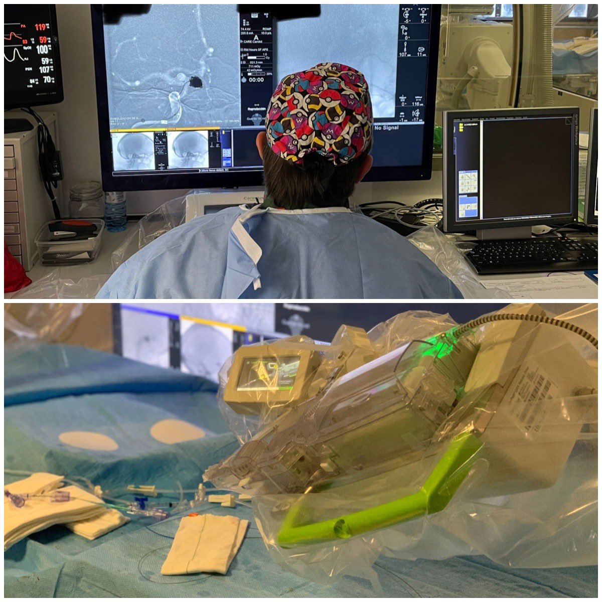 We’ve performed our first robotic procedure for treating an intracranial aneurysm endovascularly. This is the beginning of an innovative technology, unbelievable years ago. Proud and grateful to be INR nowadays