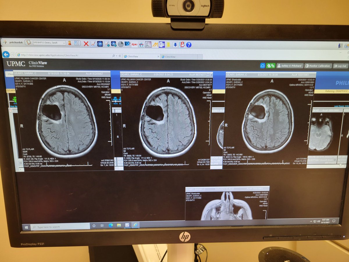 BullDual's tweet image. 8/20-5/21-8/21. Still keeping cancer beast at bay. #fuckoffcancer