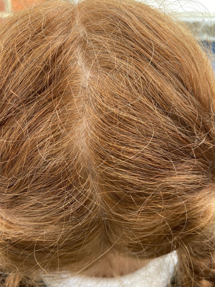 PrimaryWoodside's tweet image. Woodside celebrated World Afro Day with an assembly celebrating our diverse hairstyles #WorldAfroDay #ADOPTTHECODE #HALOHAIR