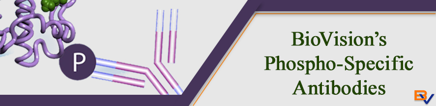 BioVision_Inc's tweet image. BioVision offers various phospho-specific antibodies to aid life science research in fields such as cancer, neuroscience, epigenetics, and metabolism. hubs.ly/H0Xc1fr0  #biotech #biotechnology #science #biology #microbiology #research #dna #molecularbiology