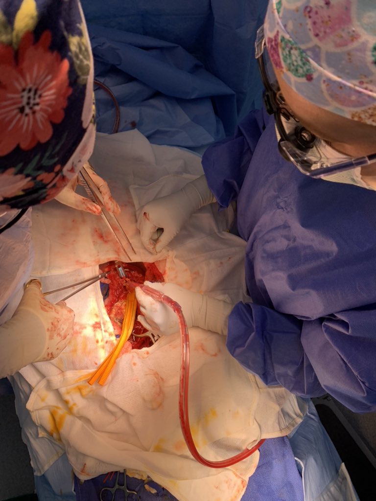 Flowered Hats Fixing Aneurysms Well #Aorta #AortaEd <a href="/DrParikhVasc/">Rajavi Parikh</a>