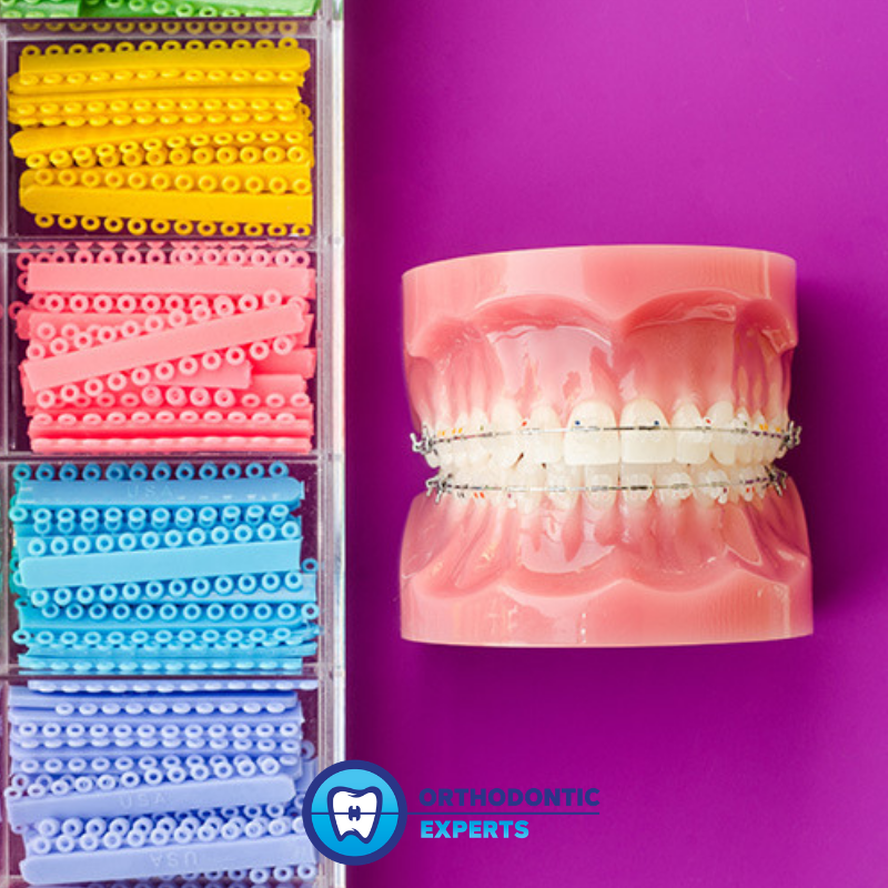OrthoExpertsCO's tweet image. We offer many different kinds of fun colors to choose from. See them all in our Braces Color video: hubs.la/H0Xll1l0  #OrthodonticExperts #BracesColors #FunColors #TopOrthodontist #BestOrthodontistInColorado