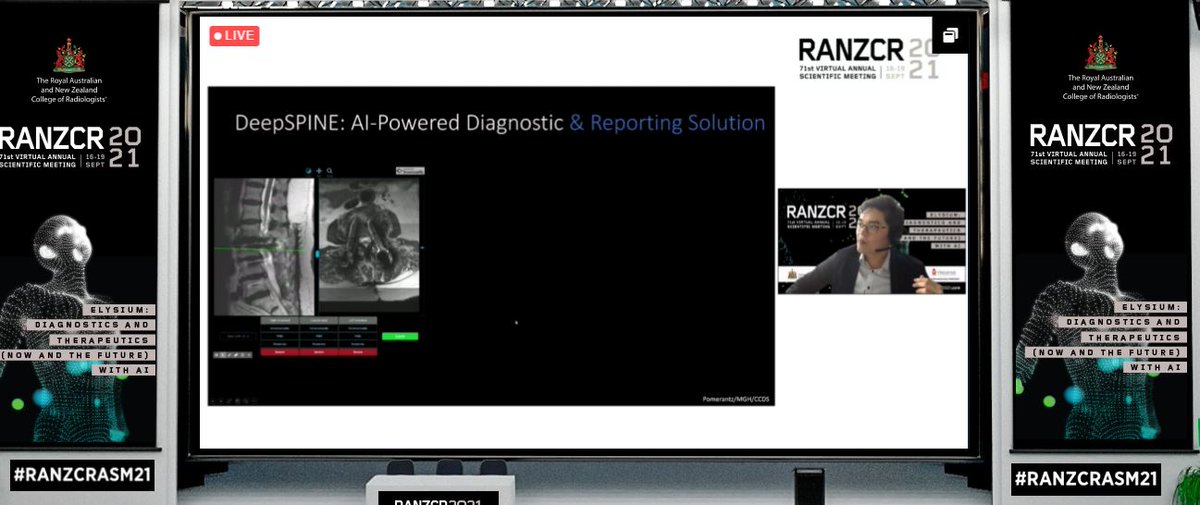 #RANZCRASM21 AI Session 3 with Dr Jarrel Seah (<a href="/jarrelscy/">Jarrel Seah</a>) talking about the impact of radiologists' accuracy using the <a href="/annalise_ai/">annalise.ai</a> system and #MGHImaging Professor Gonzalez, <a href="/pomerad/">pomerad</a> and <a href="/jentanglu/">Jen-Tang Lu</a> #DeepSPINE solution