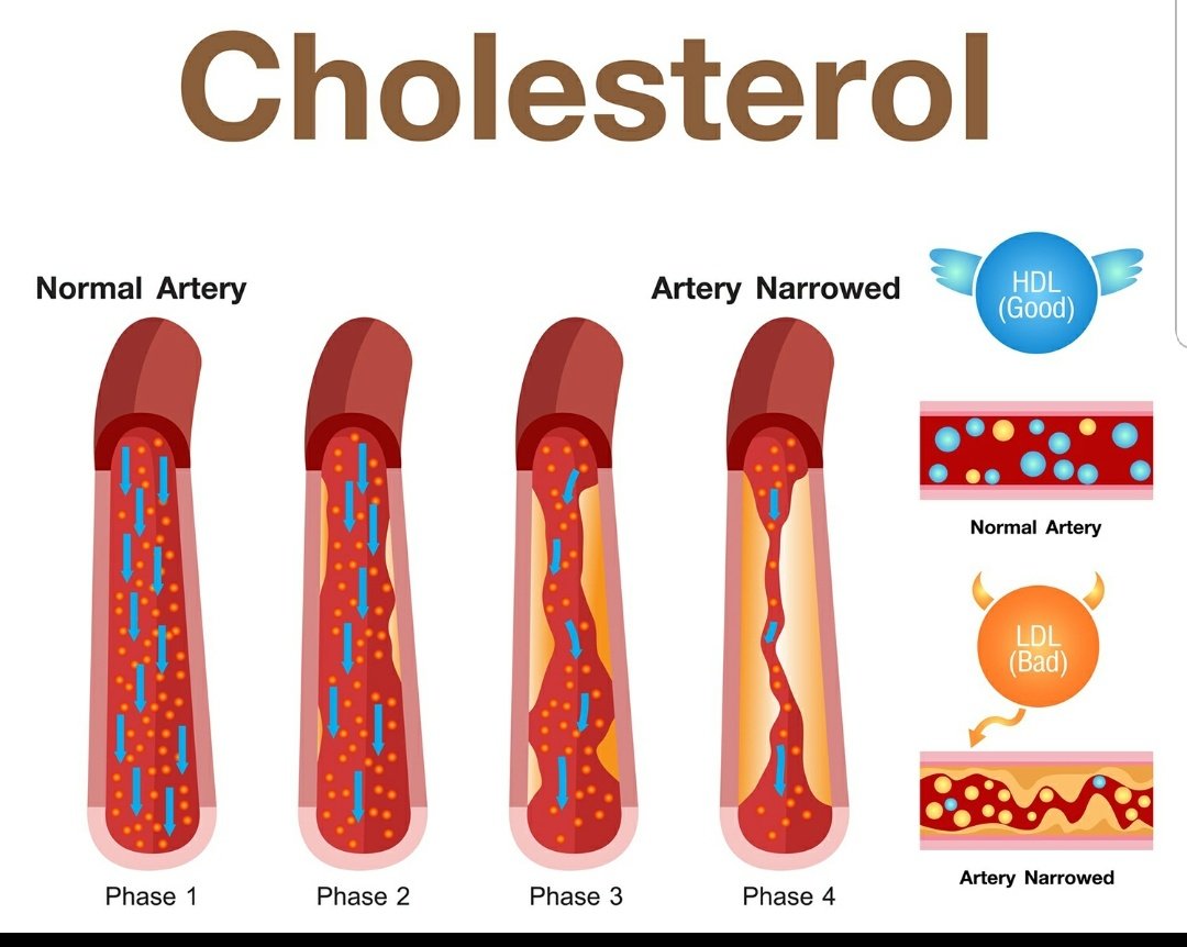 TheTalkDoctor_'s tweet photo. 3. Unhealthy diets, Lack of Exercise, Obesity(BMI>30), Smoking & Excessive drinking causes high cholesterol in the body.
4.Getting your cholesterol levels checked is an important part of staying healthy & helps you stay in control of your health
#CheckYourCholesterol https://t.co/TZHVVtiin7