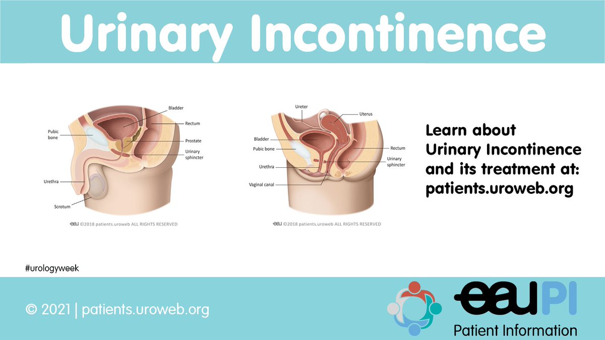 This year’s theme of EAU’s #urologyweek (20-24 Sept) is #incontinence

#DidYouKnow that it is a common urological condition? It can be treated or cured with various treatment options.

  ℹ️ bit.ly/39b3kSV
🖨️bit.ly/3tIBirv

@WFIP_Official @icsoffice @Uroweb