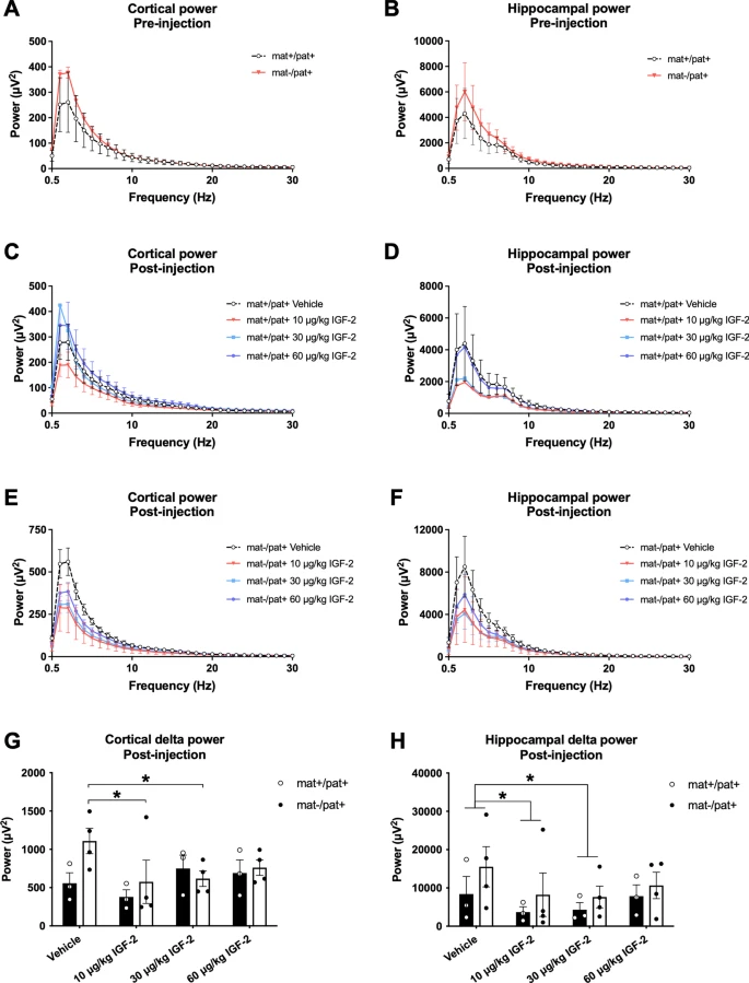 Molecular Autism (@molecularautism) on Twitter photo Insulin-like growth factor-2 does not improve behavioral deficits in mouse and rat models of Angelman Syndrome
<a href="/Iheartneuro/">Heather Born</a> @jill_silverman_ <a href="/UCDMINDINST/">UCDavisMINDInstitute</a> <a href="/BCMFromtheLabs/">From the Labs at Baylor College of Medicine</a> <a href="/PennMedicine/">Penn Medicine</a>
molecularautism.biomedcentral.com/articles/10.11… Insulin-like growth factor-2 does not improve behavioral deficits in mouse and rat models of Angelman Syndrome
<a href="/Iheartneuro/">Heather Born</a> @jill_silverman_ <a href="/UCDMINDINST/">UCDavisMINDInstitute</a> <a href="/BCMFromtheLabs/">From the Labs at Baylor College of Medicine</a> <a href="/PennMedicine/">Penn Medicine</a>
molecularautism.biomedcentral.com/articles/10.11…