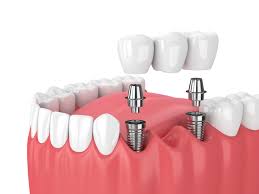 Teeth_Planting tweet picture