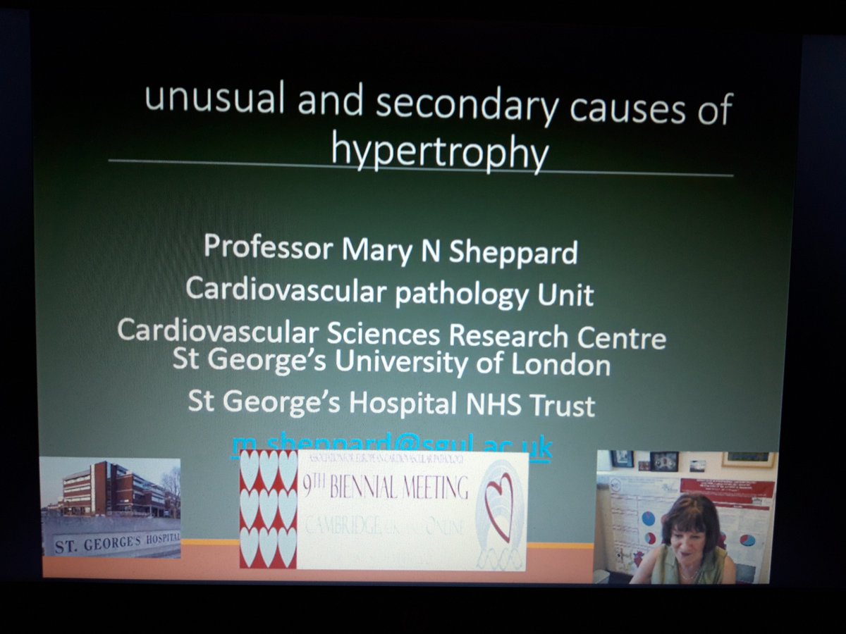 Ivana Kholová (@ivanakholova) on Twitter photo Prof. Mary Sheppard <a href="/SheppardNoelle/">Mary Noelle Sheppard</a> is talking on unusual and secondary causes of hypertrophy at <a href="/AECVPCam2021/">AECVP Cambridge 2021</a> @Associa00047104 #cardiacpath #CVpath Prof. Mary Sheppard <a href="/SheppardNoelle/">Mary Noelle Sheppard</a> is talking on unusual and secondary causes of hypertrophy at <a href="/AECVPCam2021/">AECVP Cambridge 2021</a> @Associa00047104 #cardiacpath #CVpath