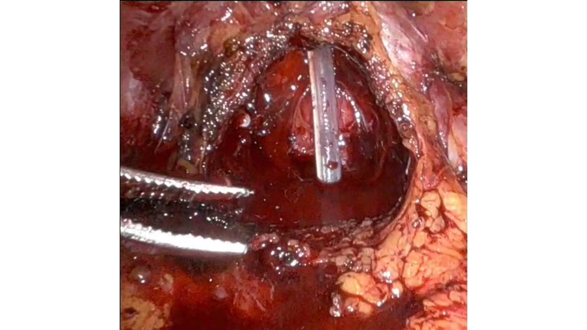 Franco Gaboardi tweet media