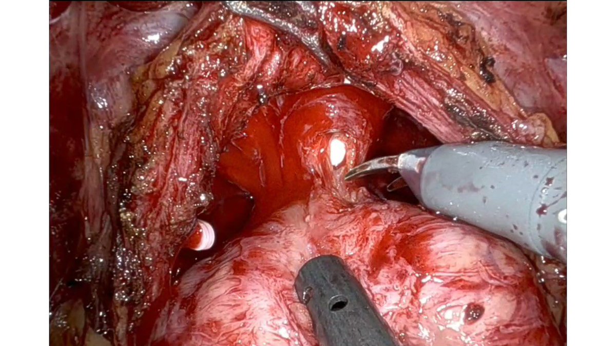 Franco Gaboardi tweet media